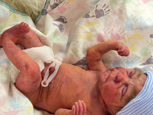 Micro preemie full body - micro,